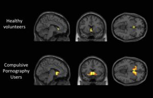 7 Scary Things Porn Does to Your Brain | Damage & Misogyny